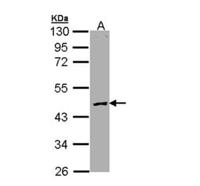Protein C antibody from Signalway Antibody (23056) - Antibodies.com