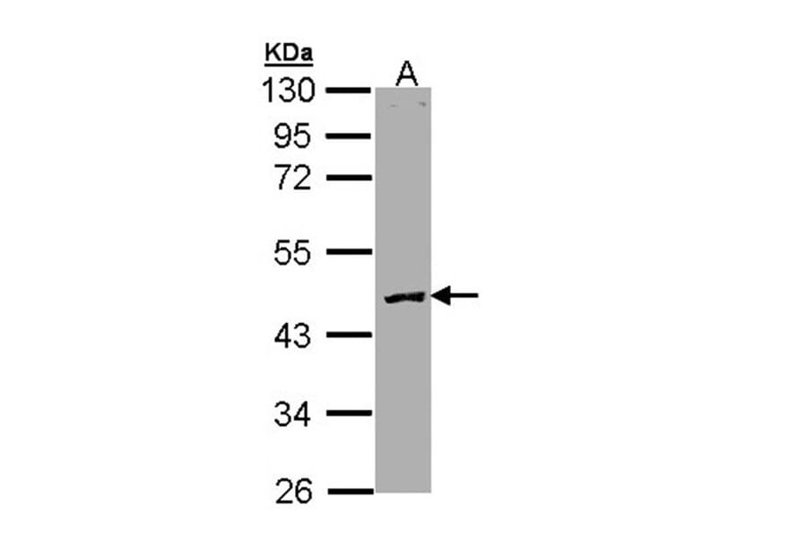 Protein C antibody from Signalway Antibody (23056) - Antibodies.com