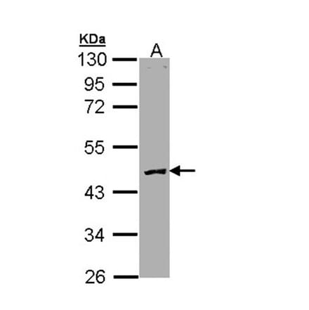 Protein C antibody from Signalway Antibody (23056) - Antibodies.com