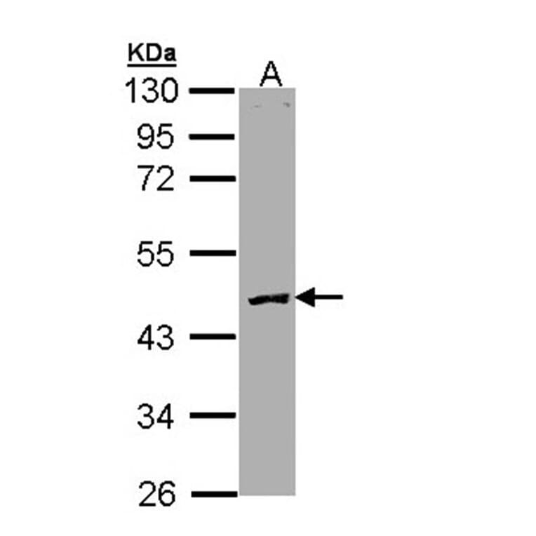 Protein C antibody from Signalway Antibody (23056) - Antibodies.com