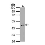 Protein C antibody from Signalway Antibody (23056) - Antibodies.com