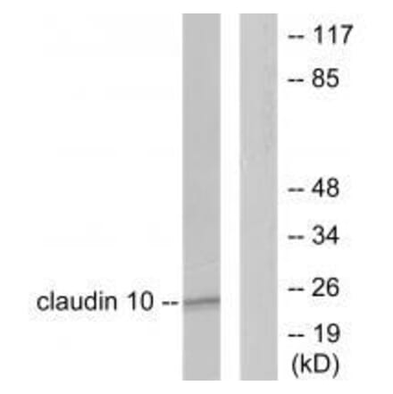 Western blot - Claudin 10 Antibody from Signalway Antibody (33338) - Antibodies.com