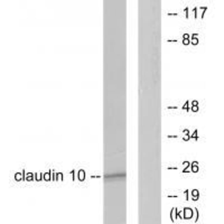 Western blot - Claudin 10 Antibody from Signalway Antibody (33338) - Antibodies.com