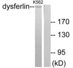 Western blot - Dysferlin Antibody from Signalway Antibody (33360) - Antibodies.com