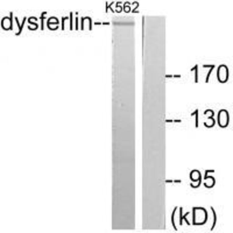Western blot - Dysferlin Antibody from Signalway Antibody (33360) - Antibodies.com