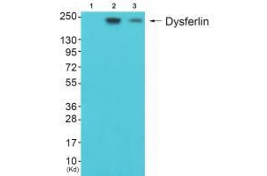 Western blot - Dysferlin Antibody from Signalway Antibody (33360) - Antibodies.com