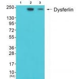 Western blot - Dysferlin Antibody from Signalway Antibody (33360) - Antibodies.com