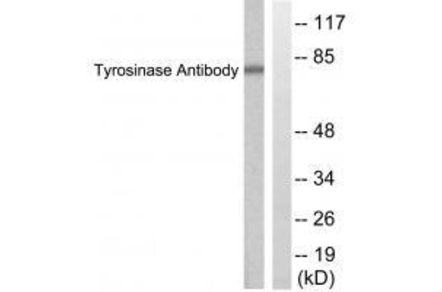 Western blot - Tyrosinase Antibody from Signalway Antibody (33534) - Antibodies.com