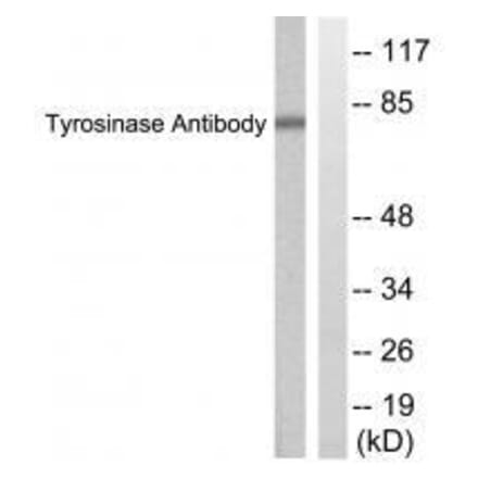 Western blot - Tyrosinase Antibody from Signalway Antibody (33534) - Antibodies.com