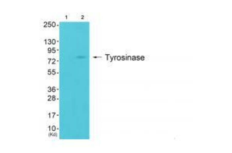 Western blot - Tyrosinase Antibody from Signalway Antibody (33534) - Antibodies.com