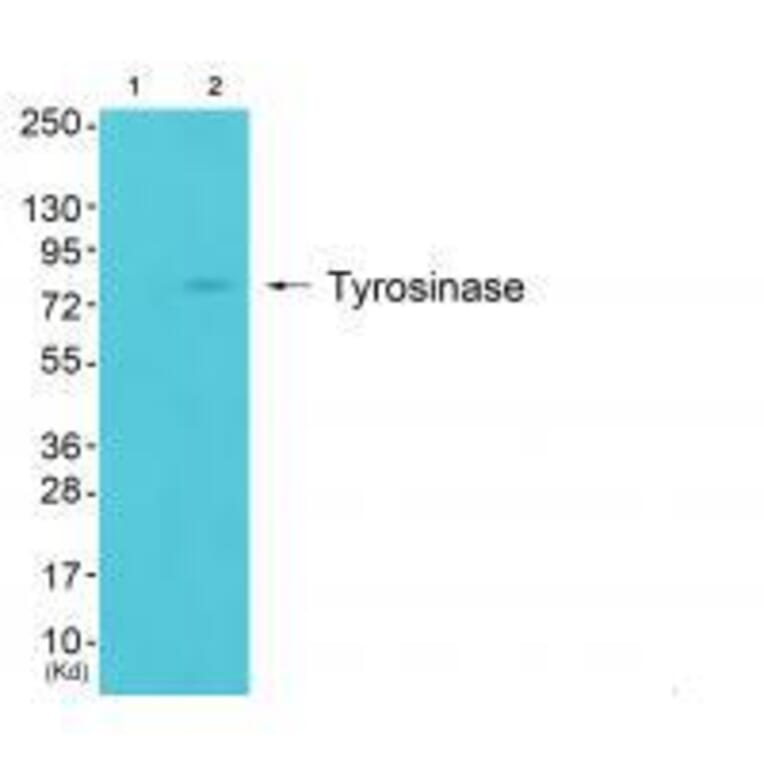 Western blot - Tyrosinase Antibody from Signalway Antibody (33534) - Antibodies.com