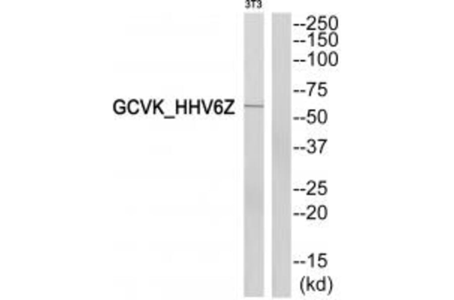Western blot - GCVK_HHV6Z Antibody from Signalway Antibody (33804) - Antibodies.com