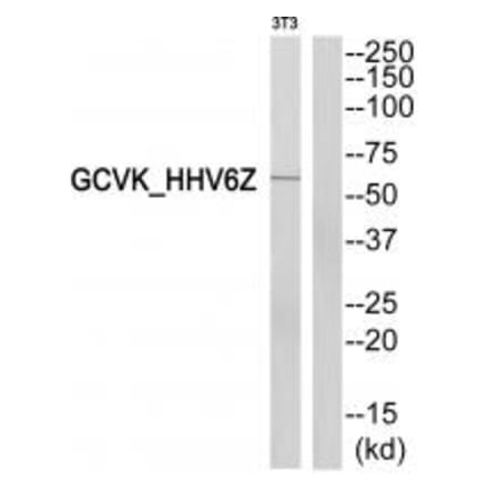 Western blot - GCVK_HHV6Z Antibody from Signalway Antibody (33804) - Antibodies.com