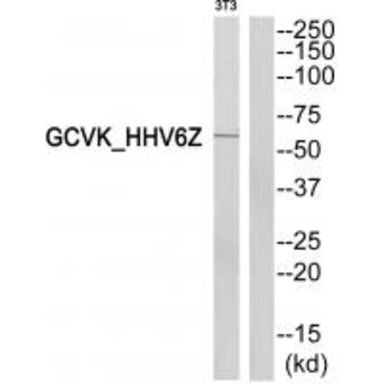 Western blot - GCVK_HHV6Z Antibody from Signalway Antibody (33804) - Antibodies.com