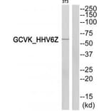 Western blot - GCVK_HHV6Z Antibody from Signalway Antibody (33804) - Antibodies.com