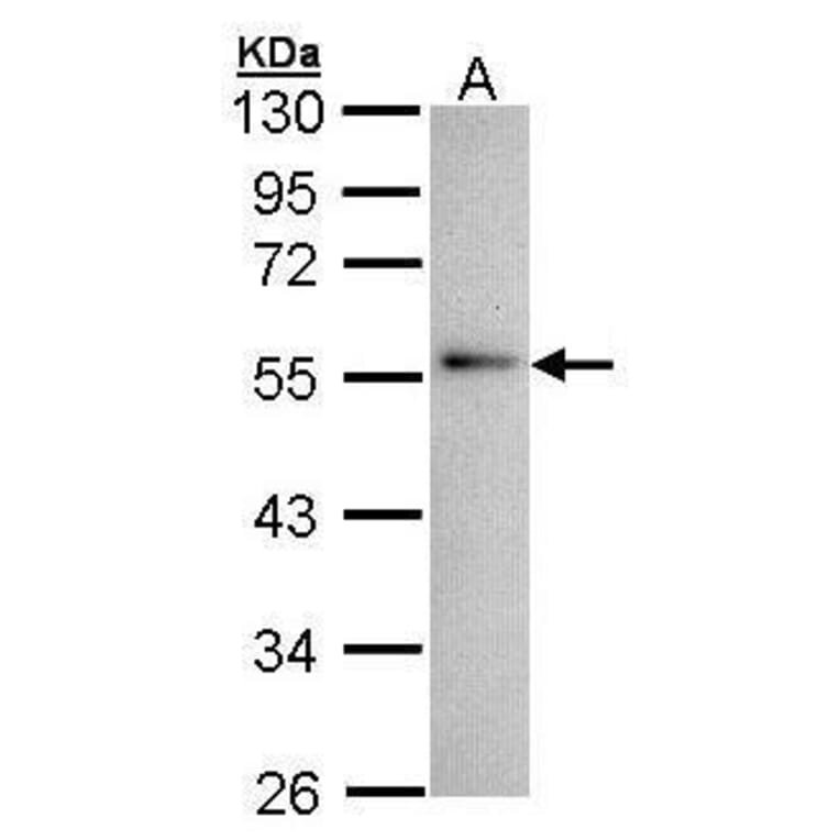 Annexin XI Antibody from Signalway Antibody (35334) - Antibodies.com