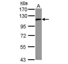 ICAM1/CD54 Antibody from Signalway Antibody (35344) - Antibodies.com