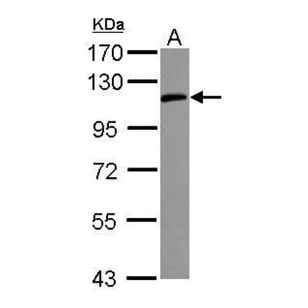 ICAM1/CD54 Antibody from Signalway Antibody (35344) - Antibodies.com