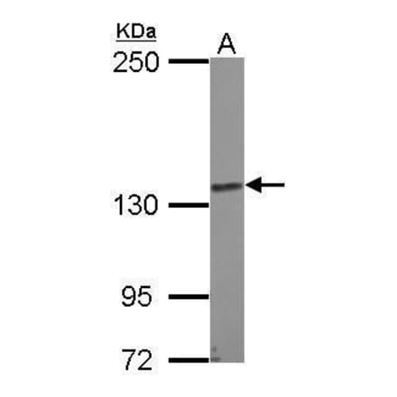 N-cadherin Antibody from Signalway Antibody (35357) - Antibodies.com