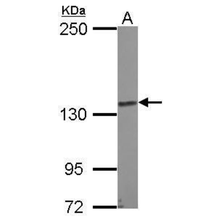 N-cadherin Antibody from Signalway Antibody (35357) - Antibodies.com