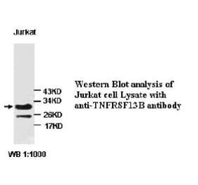 TNF RSF13B Antibody from Signalway Antibody (39224) - Antibodies.com