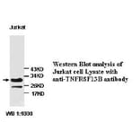 TNF RSF13B Antibody from Signalway Antibody (39224) - Antibodies.com
