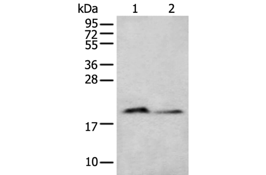 KRTAP11-1 Antibody from Signalway Antibody (43665) - Antibodies.com