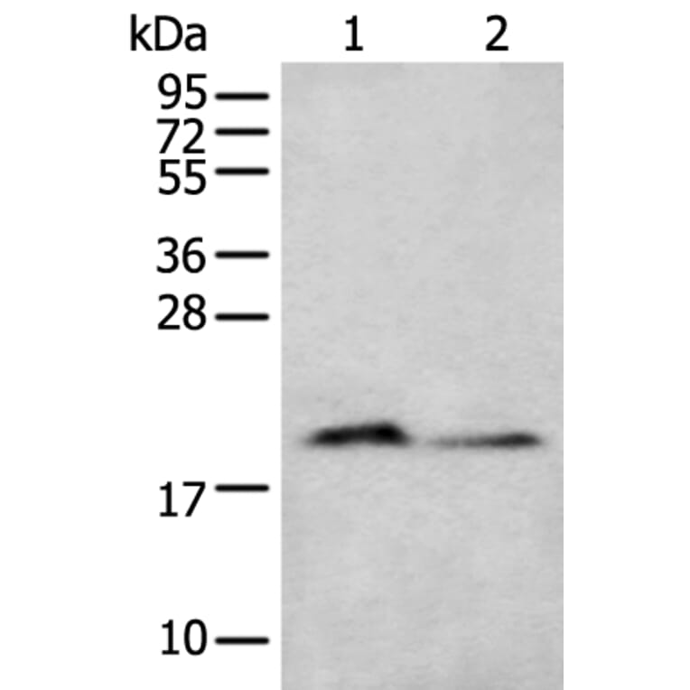 KRTAP11-1 Antibody from Signalway Antibody (43665) - Antibodies.com