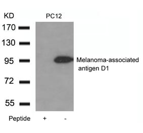 Western blot - Melanoma-associated antigen D1 Antibody from Signalway Antibody (21408) - Antibodies.com