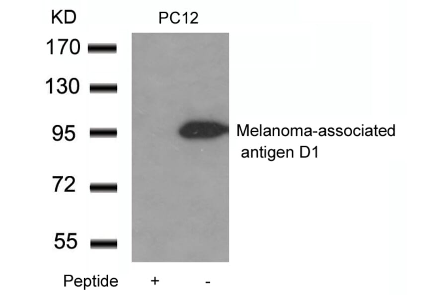Western blot - Melanoma-associated antigen D1 Antibody from Signalway Antibody (21408) - Antibodies.com