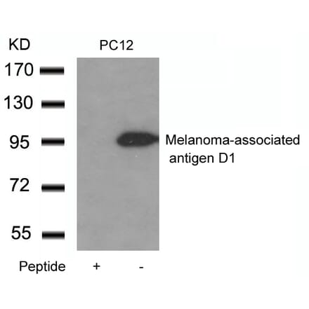 Western blot - Melanoma-associated antigen D1 Antibody from Signalway Antibody (21408) - Antibodies.com