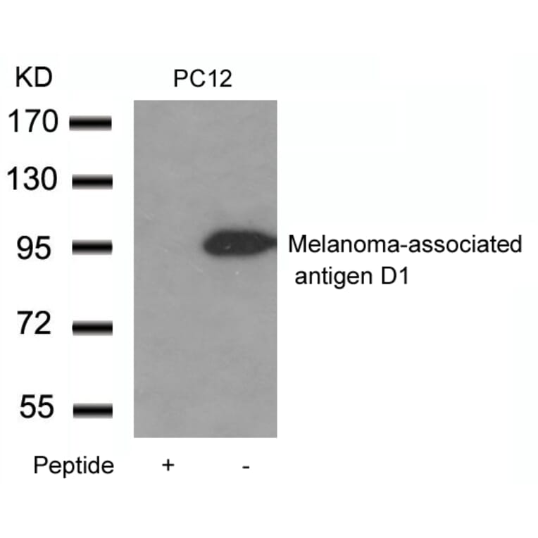 Western blot - Melanoma-associated antigen D1 Antibody from Signalway Antibody (21408) - Antibodies.com