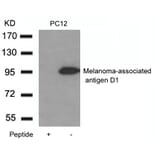 Western blot - Melanoma-associated antigen D1 Antibody from Signalway Antibody (21408) - Antibodies.com