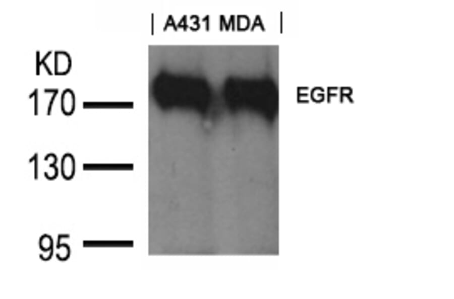 Western blot - EGFR (Ab-1197) Goat Polyclonal Antibody from Signalway Antibody (21551) - Antibodies.com
