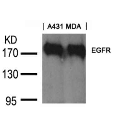 Western blot - EGFR (Ab-1197) Goat Polyclonal Antibody from Signalway Antibody (21551) - Antibodies.com