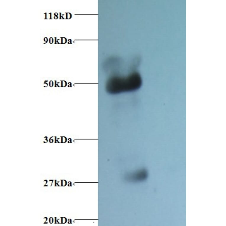 α1-acidglycoprotein Polyclonal Antibody from Signalway Antibody (42087) - Antibodies.com