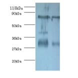 Yolk Immunoglobulin Polyclonal Antibody from Signalway Antibody (42094) - Antibodies.com