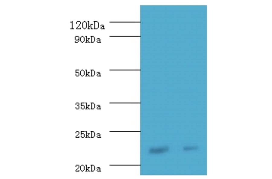 Interferon alpha-21 Polyclonal Antibody from Signalway Antibody (42218) - Antibodies.com