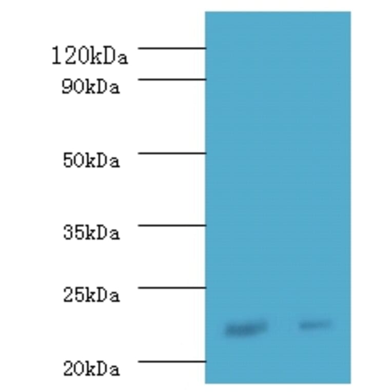 Interferon alpha-21 Polyclonal Antibody from Signalway Antibody (42218) - Antibodies.com