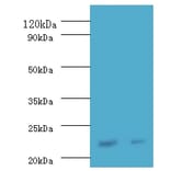 Interferon alpha-21 Polyclonal Antibody from Signalway Antibody (42218) - Antibodies.com