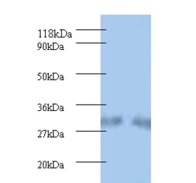 Spermidine synthase Polyclonal Antibody from Signalway Antibody (42220) - Antibodies.com