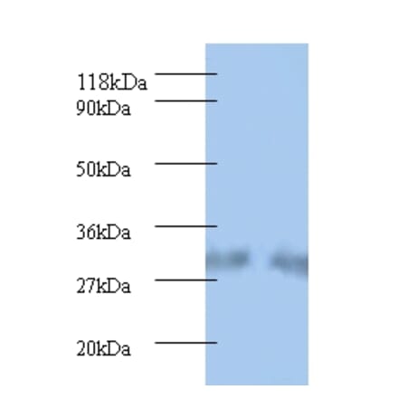 Spermidine synthase Polyclonal Antibody from Signalway Antibody (42220) - Antibodies.com