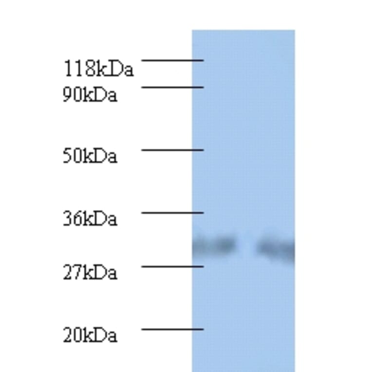 Spermidine synthase Polyclonal Antibody from Signalway Antibody (42220) - Antibodies.com