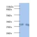 Spermidine synthase Polyclonal Antibody from Signalway Antibody (42220) - Antibodies.com