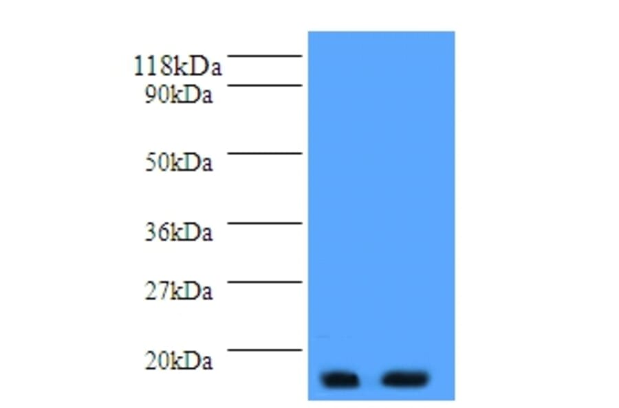 Parathyroid hormone Polyclonal Antibody from Signalway Antibody (42512) - Antibodies.com
