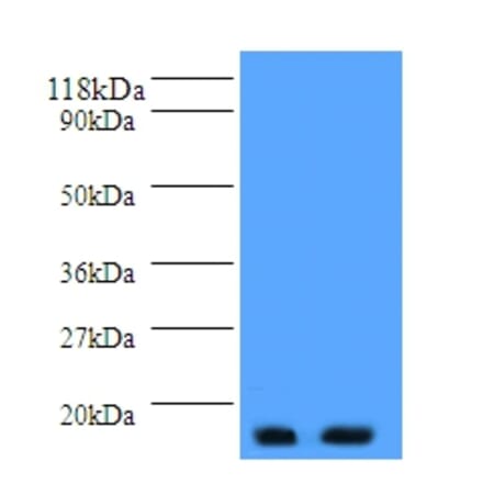 Parathyroid hormone Polyclonal Antibody from Signalway Antibody (42512) - Antibodies.com