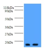 Parathyroid hormone Polyclonal Antibody from Signalway Antibody (42512) - Antibodies.com