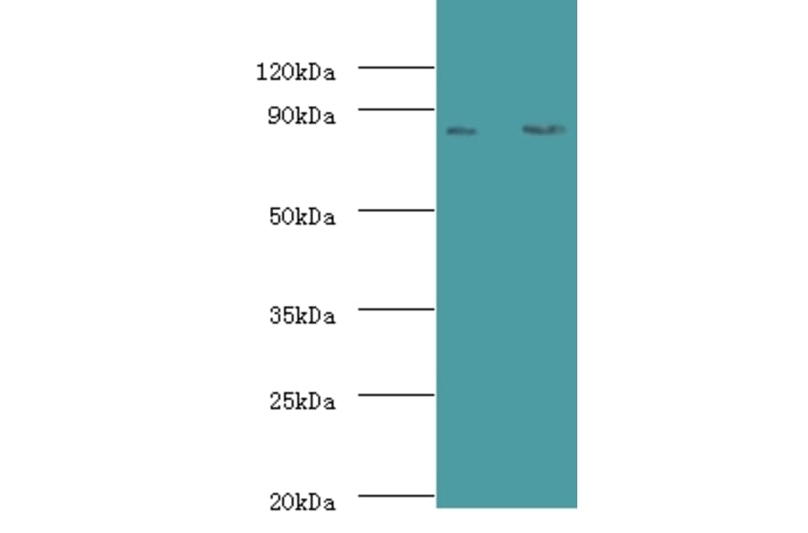 Complement factor B Polyclonal Antibody from Signalway Antibody (42533) - Antibodies.com