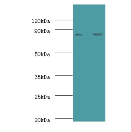 Complement factor B Polyclonal Antibody from Signalway Antibody (42533) - Antibodies.com