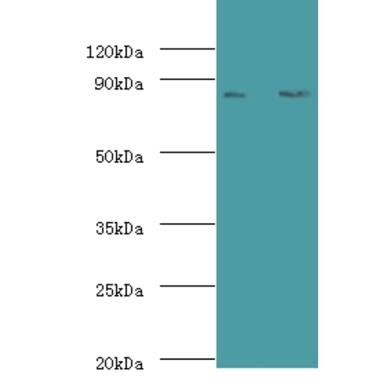 Complement factor B Polyclonal Antibody from Signalway Antibody (42533) - Antibodies.com